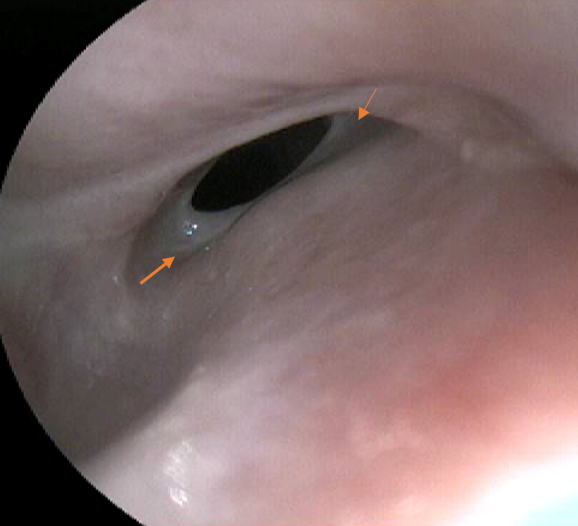 oesophagus